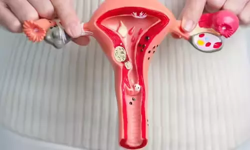 கருப்பை இறக்கம் வராமல் தடுக்கும் உடற்பயிற்சி - எளிய சிகிச்சைகள்