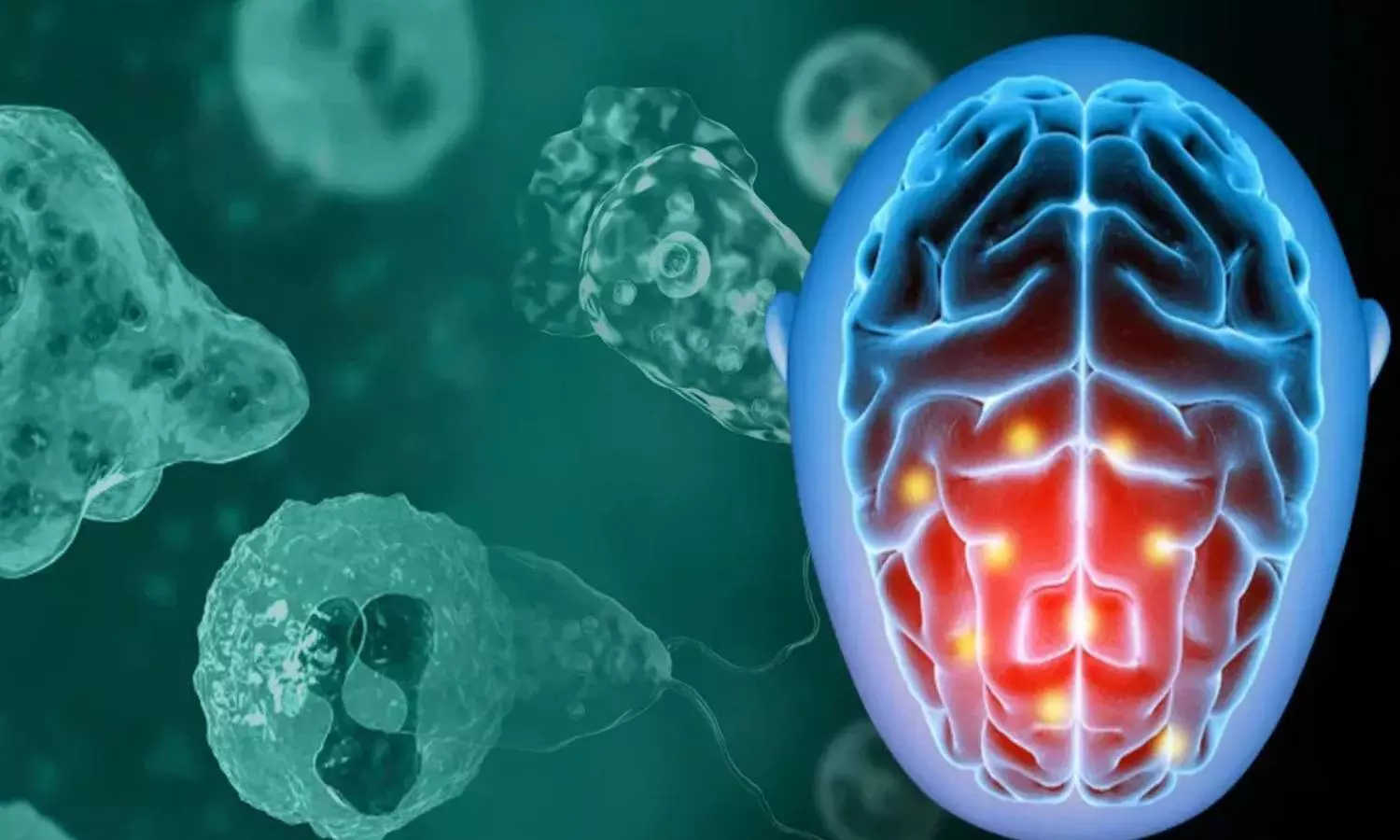 கோழிக்கோட்டில் மீண்டும் பரவும் அமீபிக் மூளைக்காய்ச்சல்: 3 மாத குழந்தை-வாலிபர் பாதிப்பு