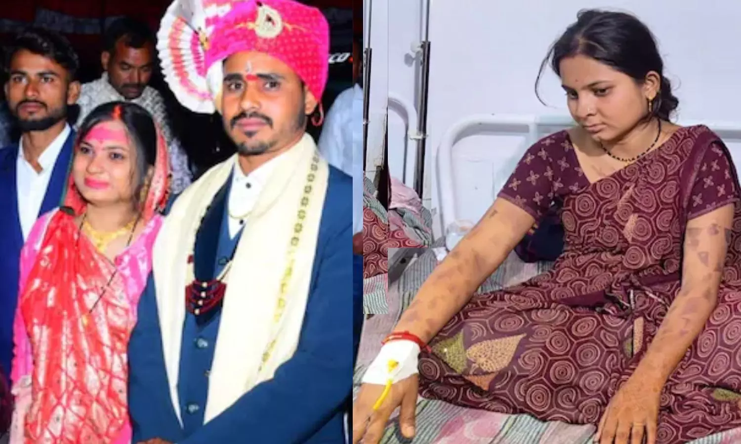 வரதட்சணை கொண்டு வராத மனைவியை கட்டிவைத்து  கொதிக்கும் கத்தியால் வாயில் சூடு போட்ட கொடூர கணவன்