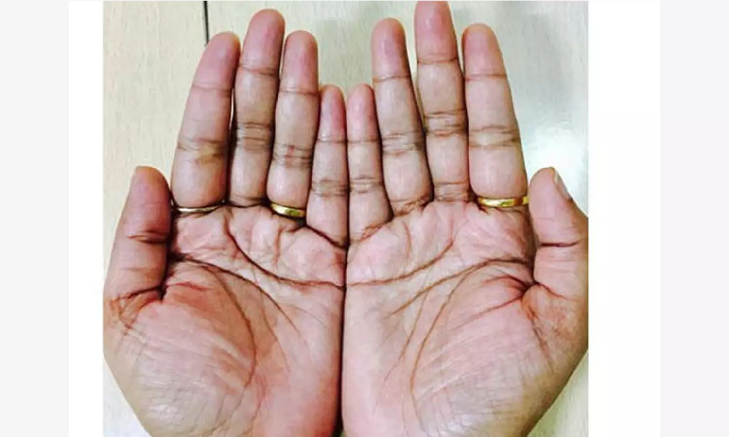 உள்ளங்கை சொல்லும் ரகசியம்!