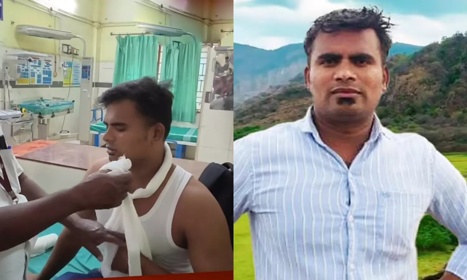 ரீல்ஸ் பிரபலம் கூமாபட்டி தங்கபாண்டிக்கு எலும்பு முறிவு!