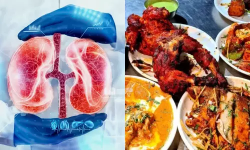 அசைவ உணவுகள்... சிறுநீரக கற்கள் ஏற்படும் அபாயத்தை அதிகரிக்குமா?