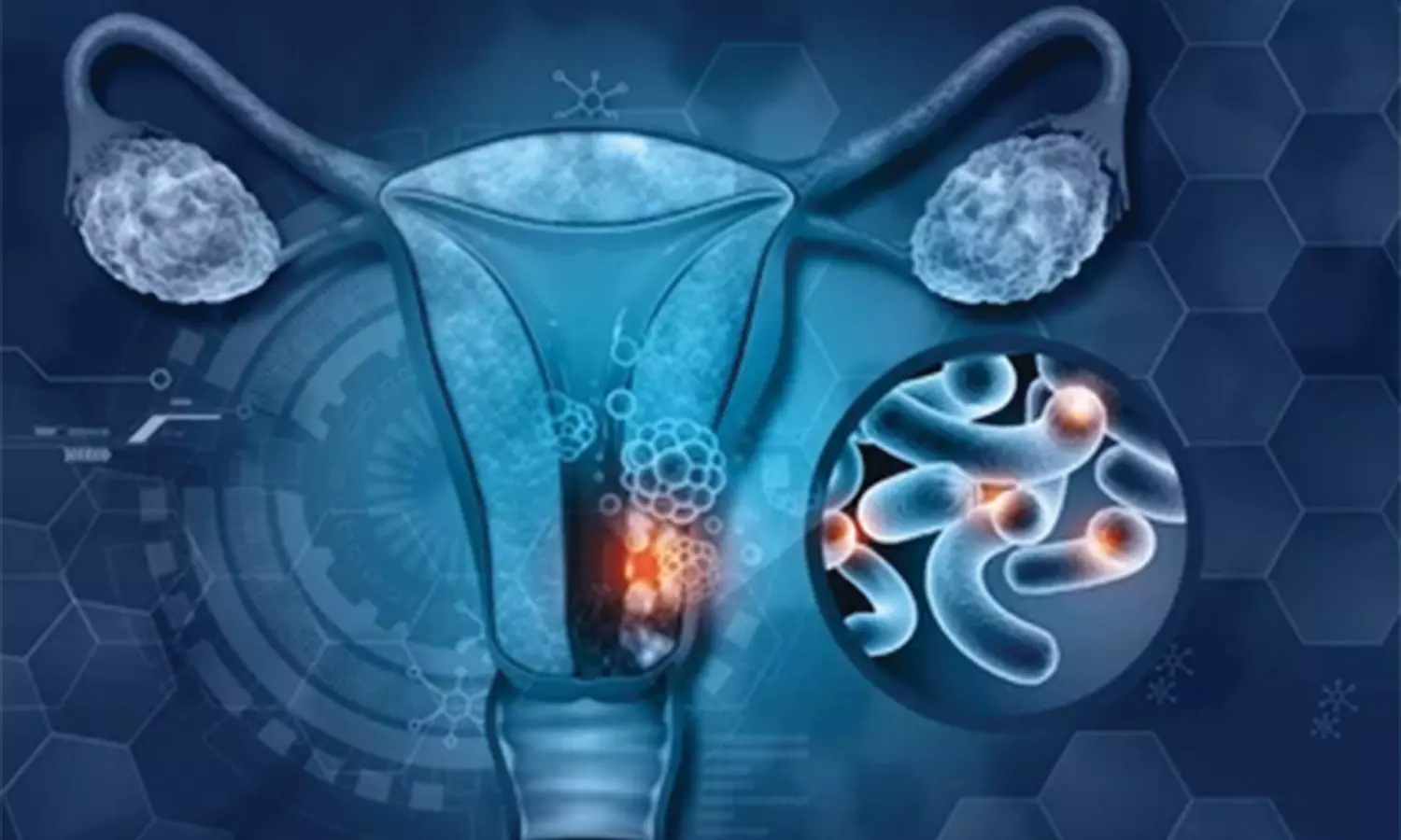 கர்ப்பப்பையில் நோய்க்கிருமிகள் பரவாமல் தடுக்கும் பாக்டீரியாக்கள்