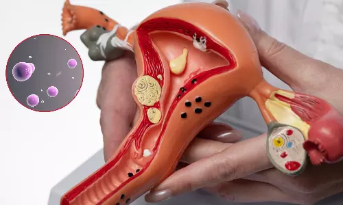 பெண்களுக்கு தொல்லை கொடுக்கும் பூஞ்சை தொற்றும், தடுக்கும் முறையும்...!