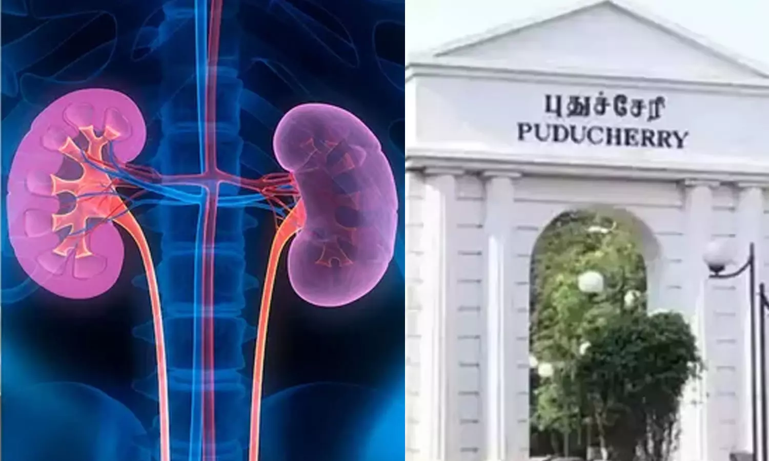 தமிழகத்தை போல புதுச்சேரியிலும் கிட்னி திருடும் மோசடி கும்பல்