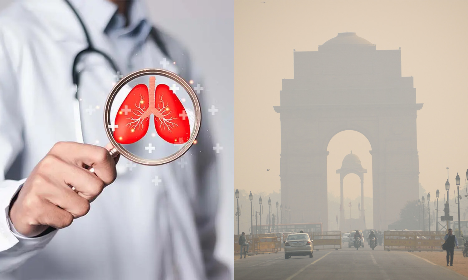 அதிகரிக்கும் காற்று மாசு: டெல்லியை விட்டு வெளியேறுங்கள் - பொதுமக்களுக்கு டாக்டர் அறிவுறுத்தல்