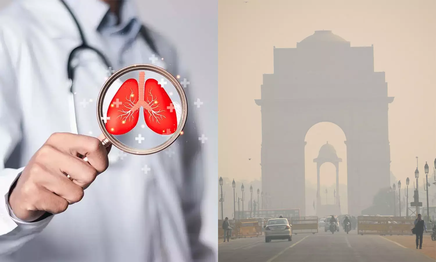 அதிகரிக்கும் காற்று மாசு: டெல்லியை விட்டு வெளியேறுங்கள் - பொதுமக்களுக்கு டாக்டர் அறிவுறுத்தல்