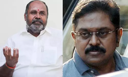 டி.டி.வி. தினகரனுக்கு மனநிலை பாதிக்கப்பட்டுவிட்டது- ஆர்.பி உதயகுமார்