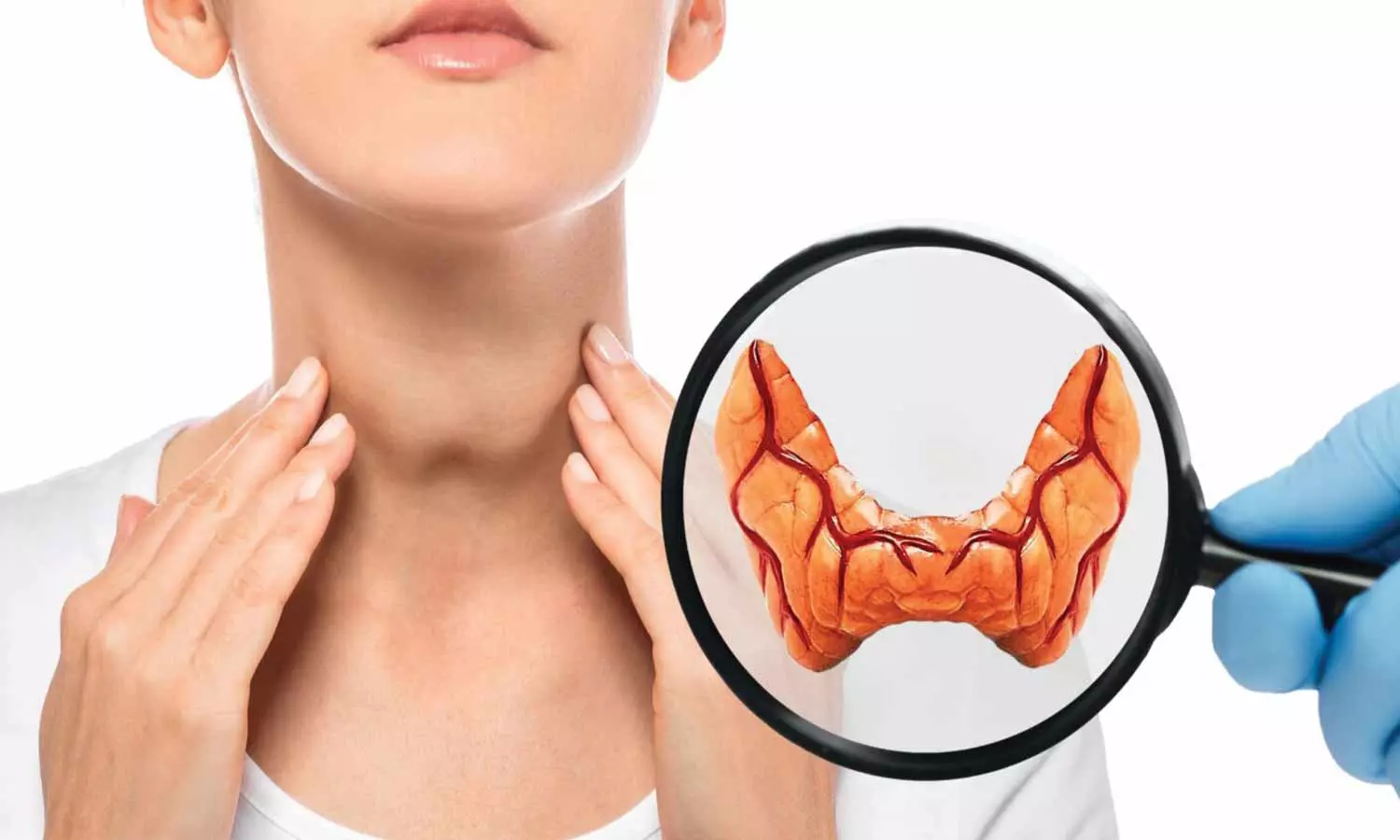 மலைப்பகுதியில் வசிப்பவர்களுக்கு தைராய்டு அதிகம் வருமா? மலைப்பகுதியில் வசிப்பவர்களுக்கு தைராய்டு அதிகம் வருமா?