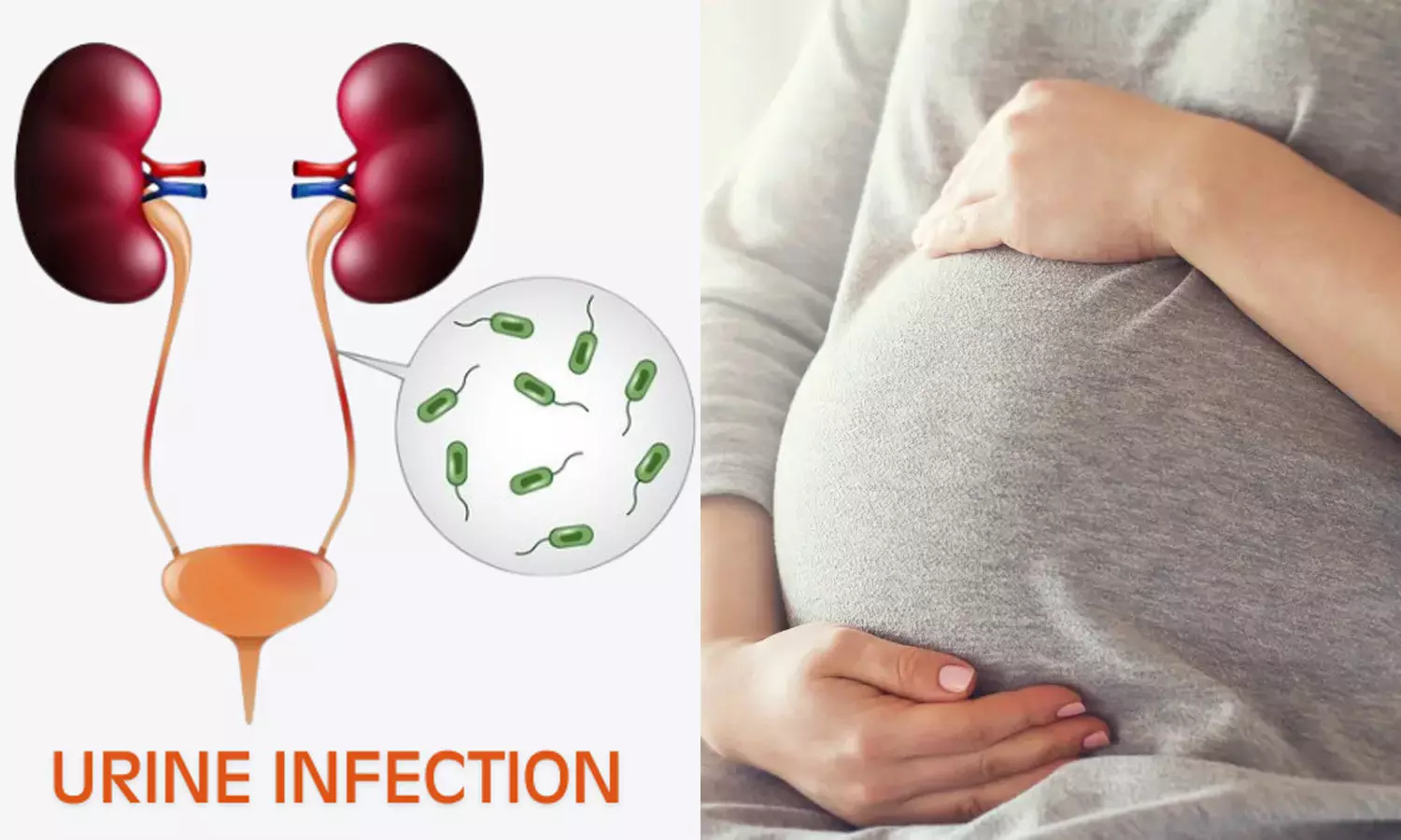 கர்ப்பகாலத்தில் பெண்களுக்கு ஏற்படும் சிறுநீர்க்குழாய் தொற்று பிரச்சனை