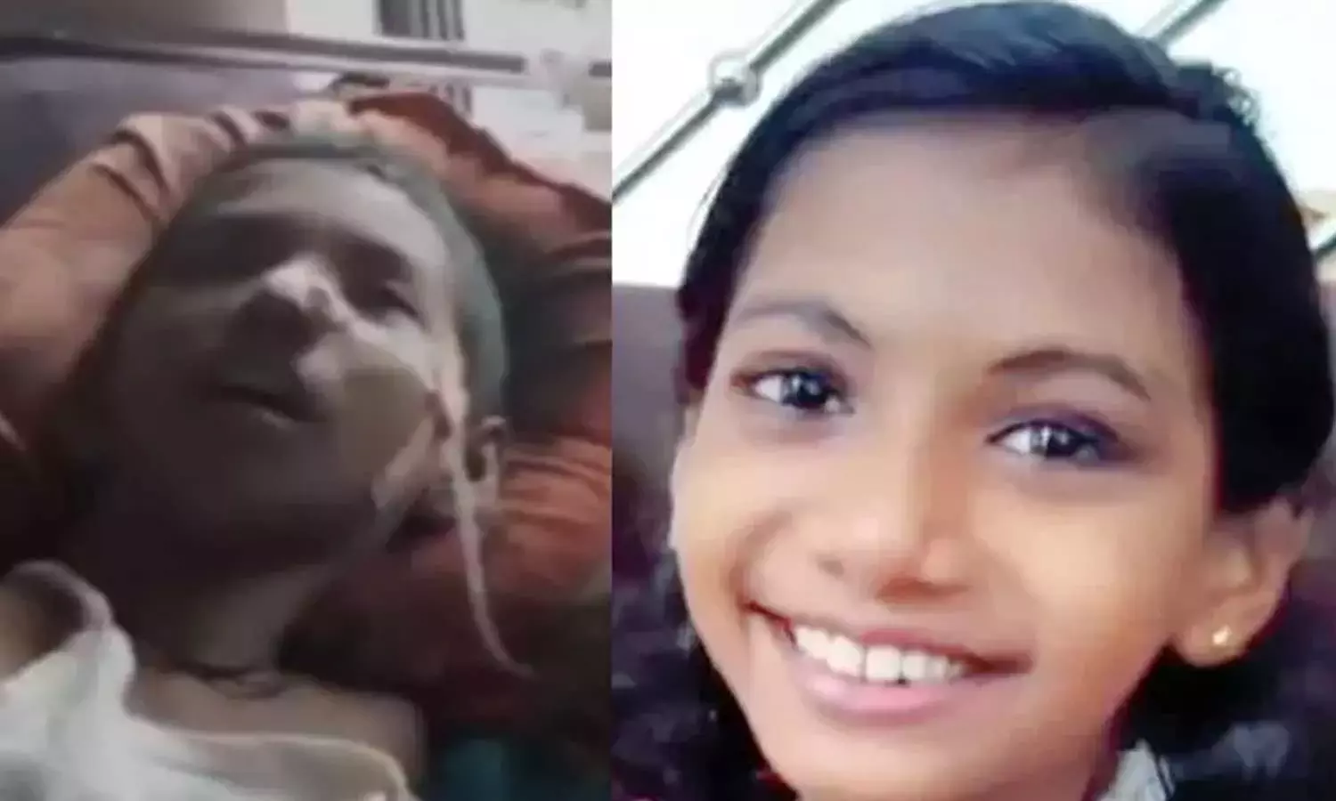 கார் மோதி விபத்து- கோமா நிலைக்கு சென்ற சிறுமியின் குடும்பத்துக்கு ரூ1.15 கோடி இழப்பீடு