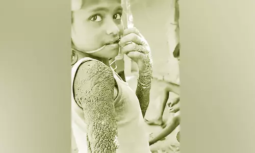 12 வயது சிறுமிக்கு உடல் முழுவதும் கல்லாக மாறும் அரிய நோய் பாதிப்பு