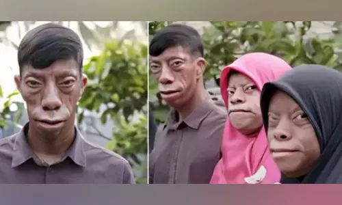 இப்படியும் ஒரு ஆச்சரியம்- ஒரே நபருக்கு 2 முகம் காலை, மாலை மாறுகிறது