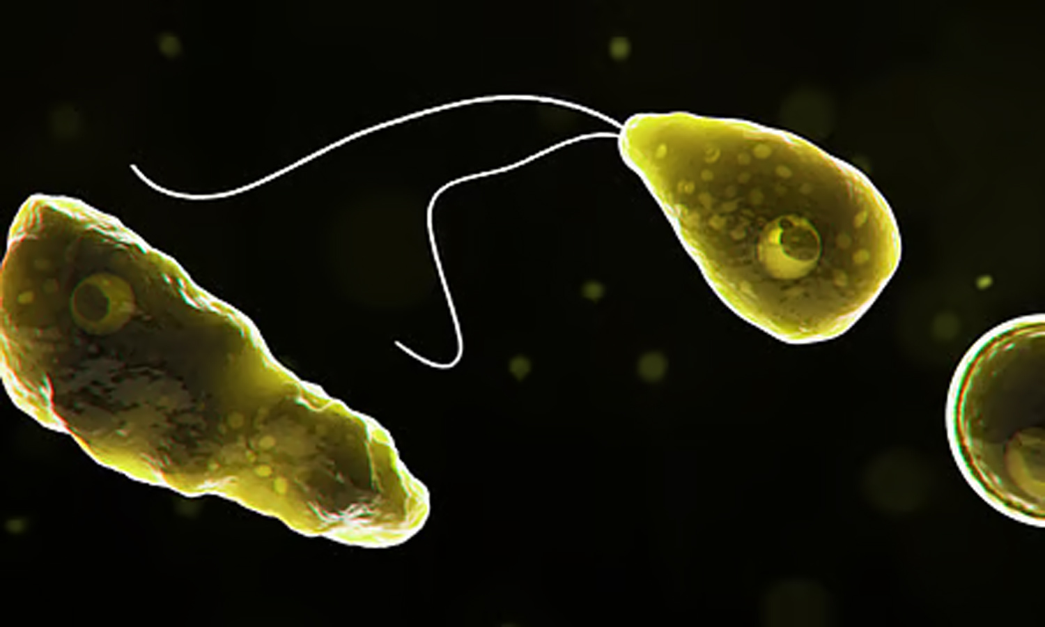 அமீபிக் மூளைக்காய்ச்சலுக்கு முதியவர் பலி