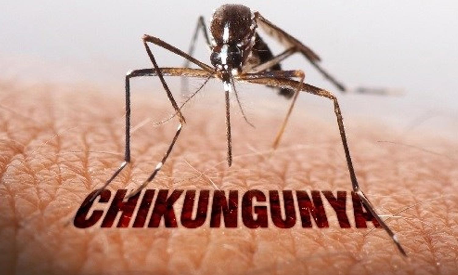 தமிழகத்தின் பல மாவட்டங்களில் சிக்குன் குனியா பாதிப்பு அதிகரிப்பு- பொது சுகாதாரத்துறை எச்சரிக்கை