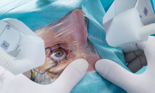 கண்புரை ஆபரேஷனில் குளறுபடி: 9 பேருக்கு கண் அகற்றப்பட்டது- மேலும் 9 பேர் பார்வை இழந்தனர்