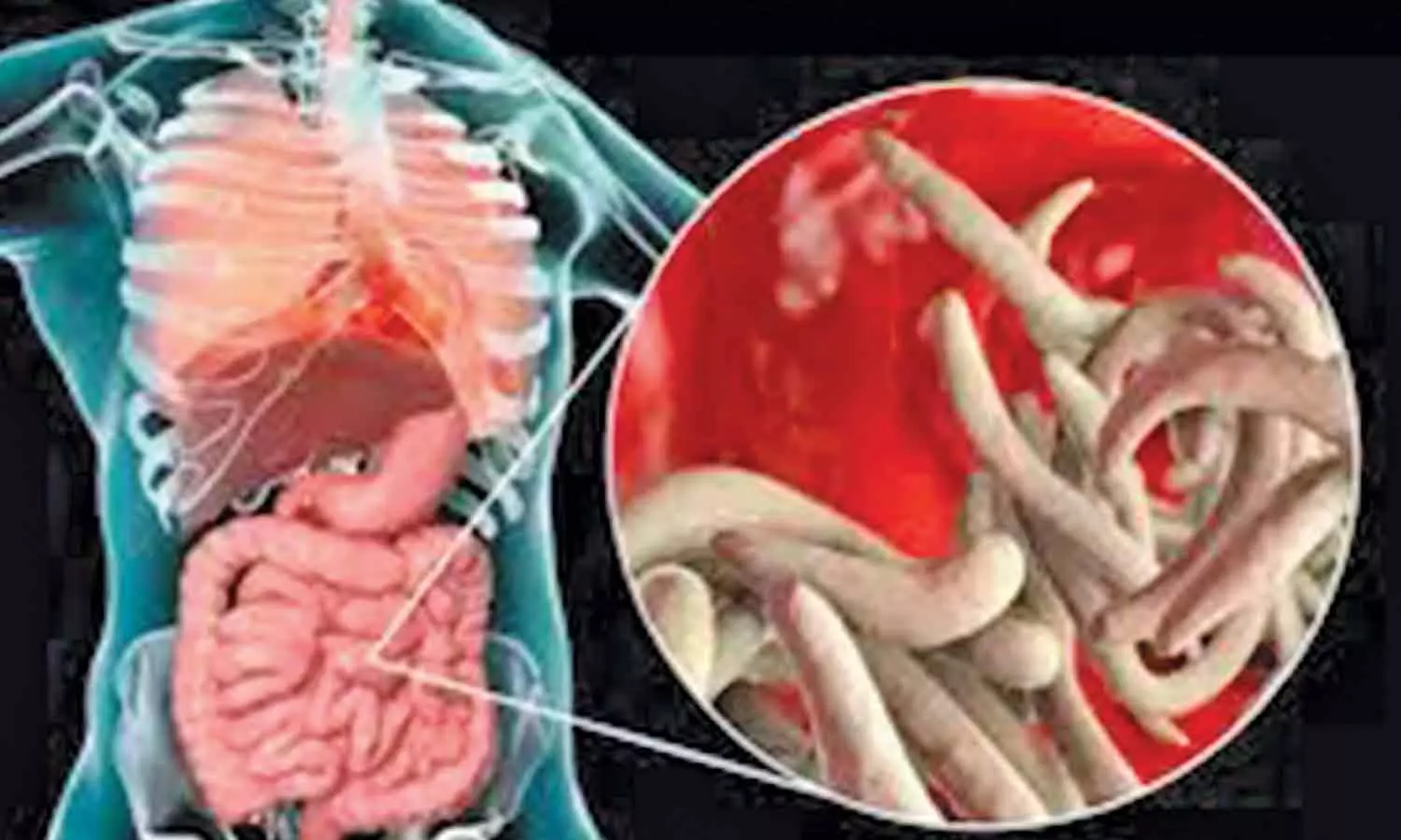 வயிற்றுக்குள் குடற்புழுக்கள் வராமல் தடுக்கும் வழிமுறைகள் வயிற்றுக்குள் குடற்புழுக்கள் வராமல் தடுக்கும் வழிமுறைகள்