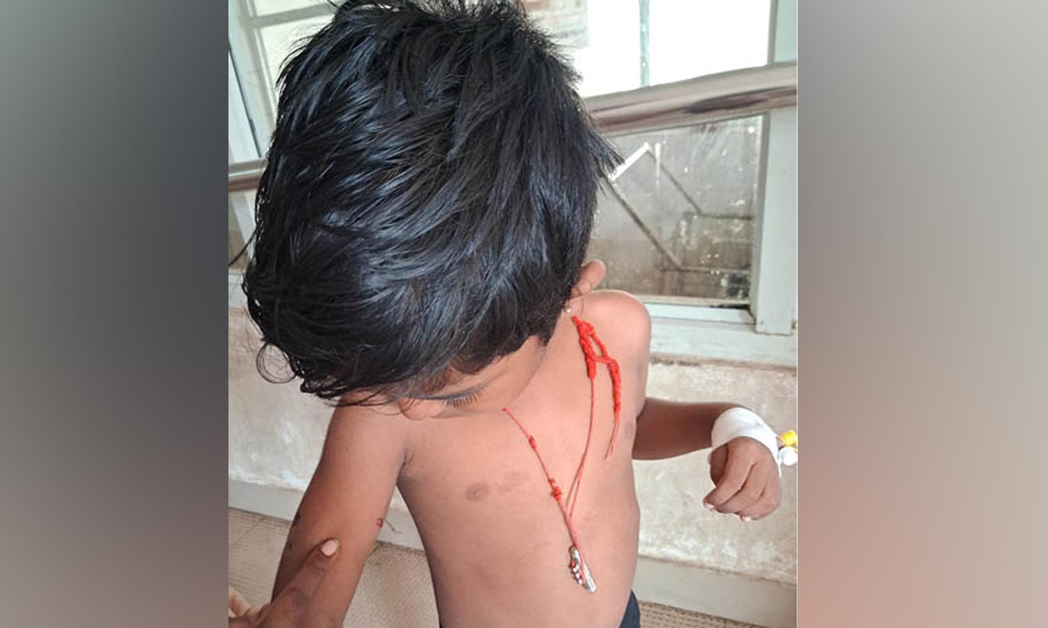 சிறுமியை விரட்டி விரட்டி கடித்த தெருநாய்- சமூக வலைதளங்களில் பரவும் வீடியோ காட்சியால் பரபரப்பு